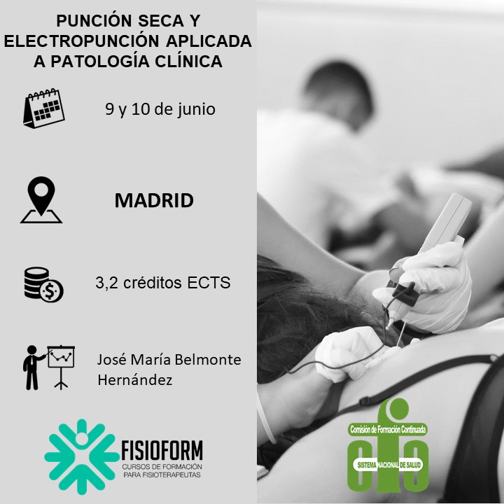 Curso punción seca y electropunción aplicada a patología clínica (Madrid)