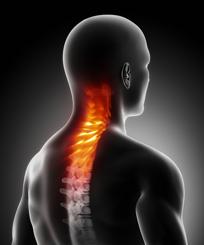 Deborah Falla: Trastornos de la Columna Cervical