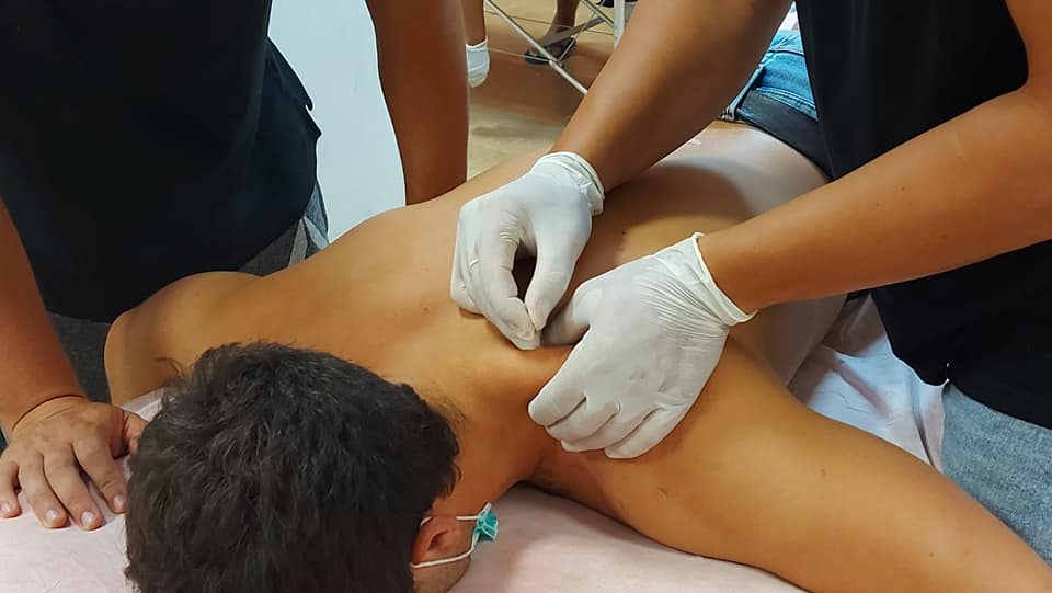 Punción Seca en Valencia Punción Seca en Valencia