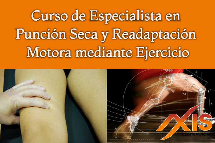 Curso de Especialista en Punción Seca y Readaptación Motora mediante Ejercicio. Edición VII Curso de Especialista en Punción Seca y Readaptación Motora mediante Ejercicio. Edición VII