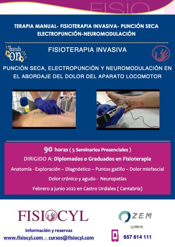 FISIOTERAPIA INVASIVA: punción seca, electropunción y neuromodulación en el abordaje del dolor 