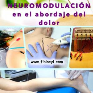 Electropunción y neuromodulación en el abordaje del dolor músculo esquelético