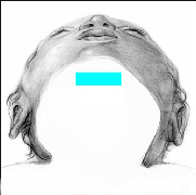 Vista de la aplicación de Vendaje Neuromuscular en el Dermatoma C4, debajo de la barbilla