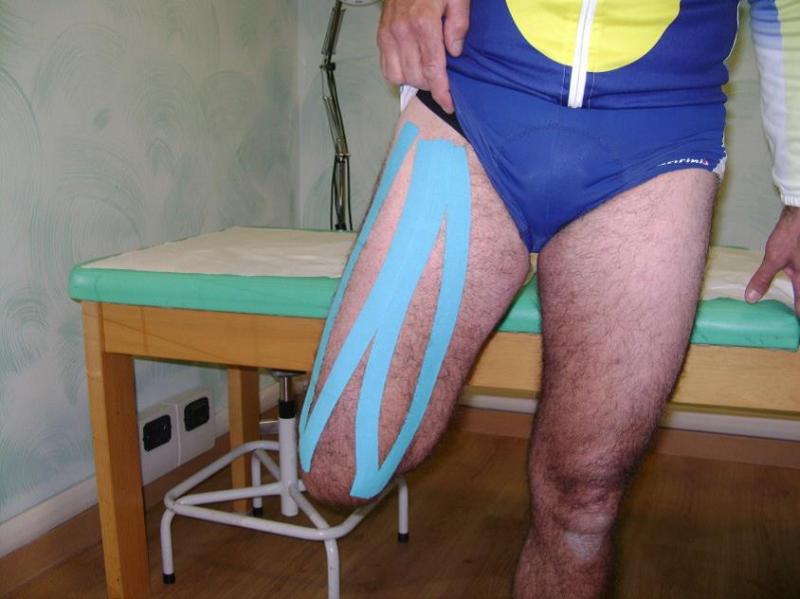 Ejemplo  aplicación en cuádriceps derecho rodilla estirada