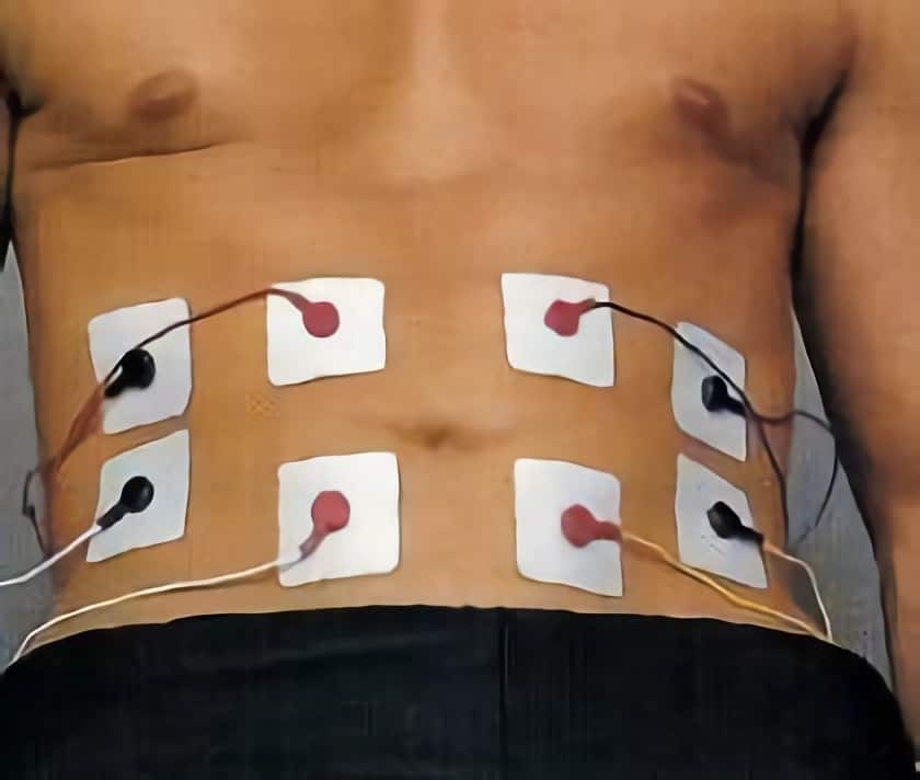 Colocación de electrodos en abdomen