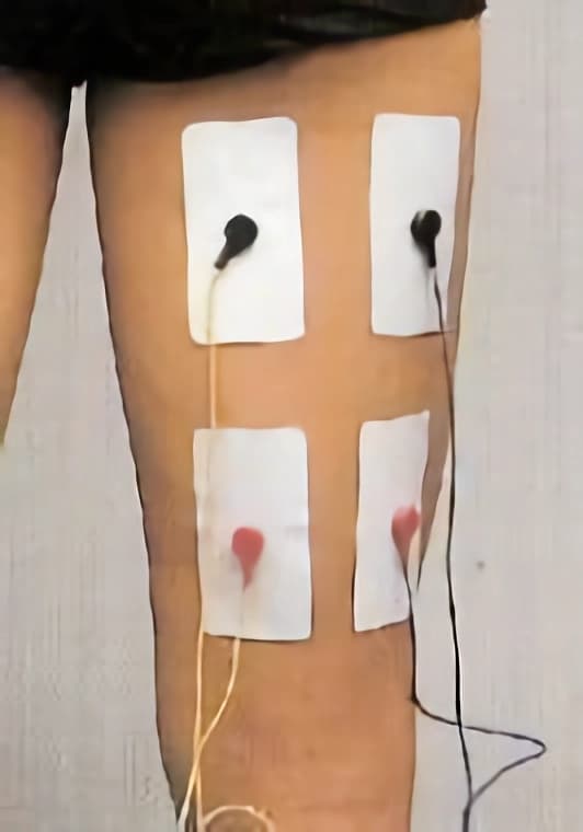 Colocación de electrodos en bíceps femoral