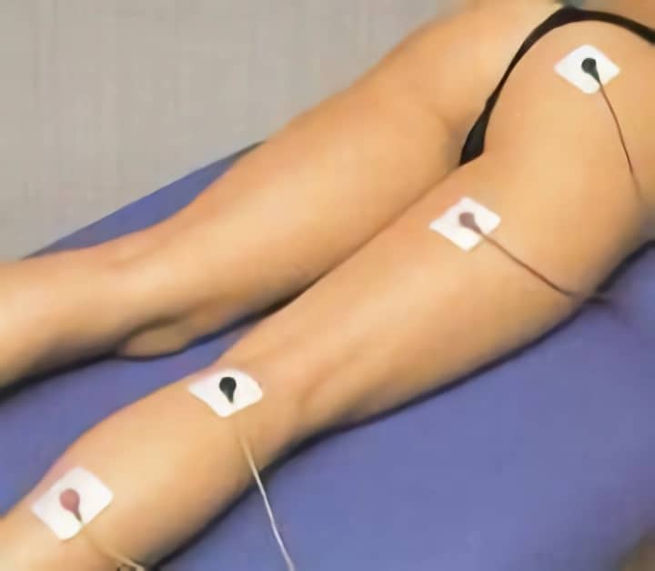 Colocación de electrodos para ciatalgia