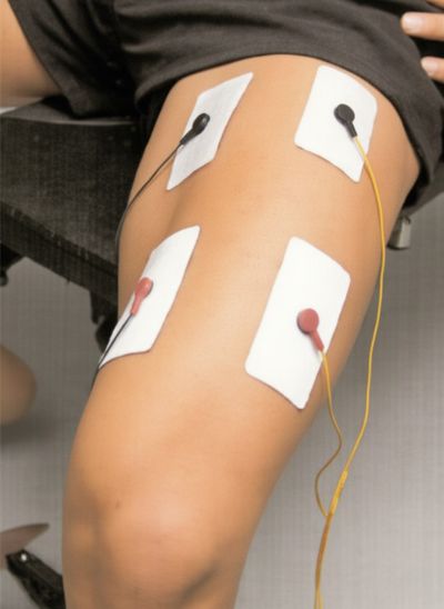 Colocación recomendada de los electrodos en cuádriceps