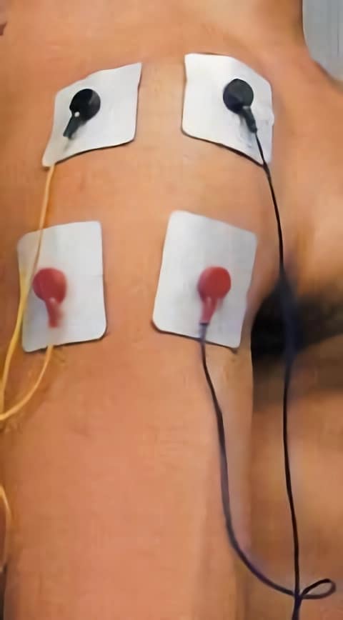 Colocación de electrodos en deltoides de hombre