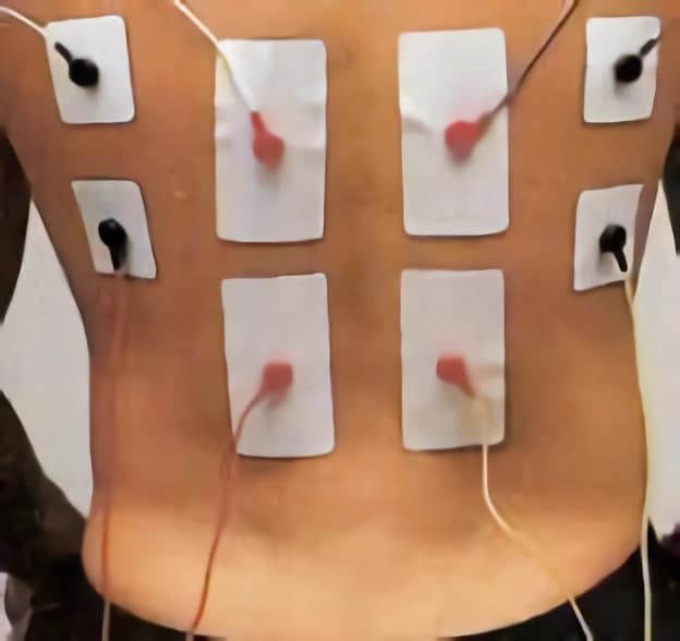 Colocación de electrodos en dorsal ancho
