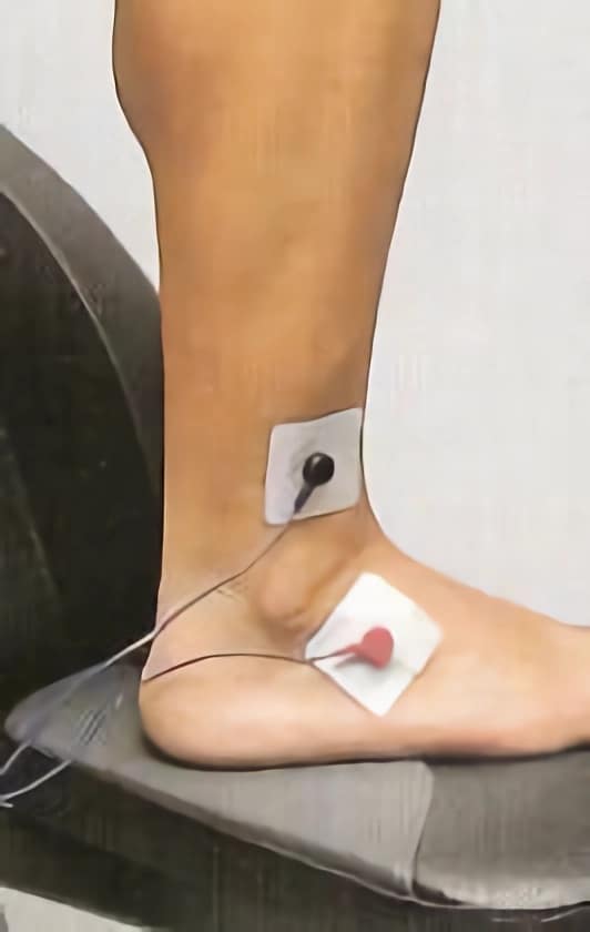 Primer plano de los electrodos de posicionamiento de la mano del  fisioterapeuta en la rodilla del paciente en el hospital