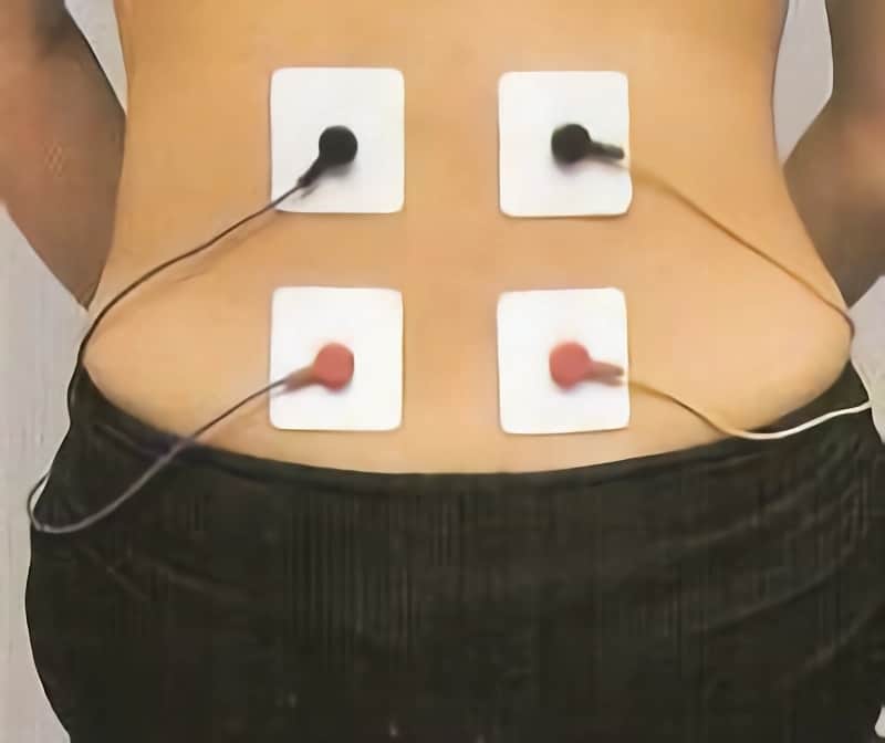 Colocación de electrodos para lumbalgia