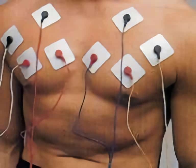 Colocación de electrodos en pectorales