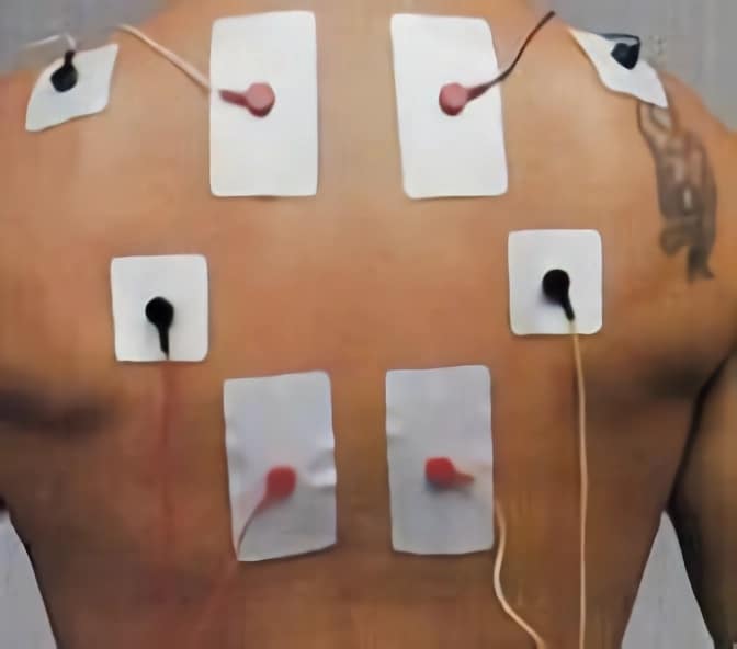 Guía para la colocación de electrodos en fisioterapia - Blog de fisioterapia