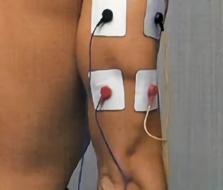 Colocación de electrodos en tríceps