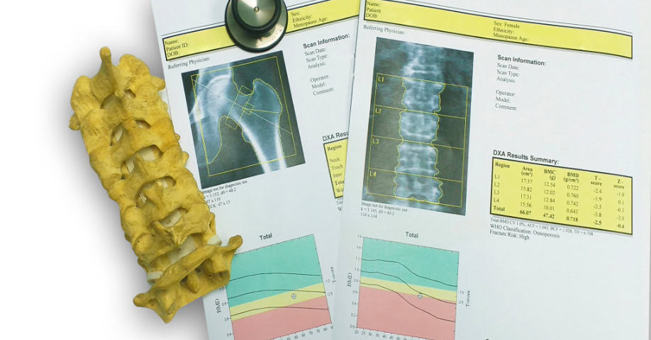 Pruebas diagnósticas de osteonecrosis