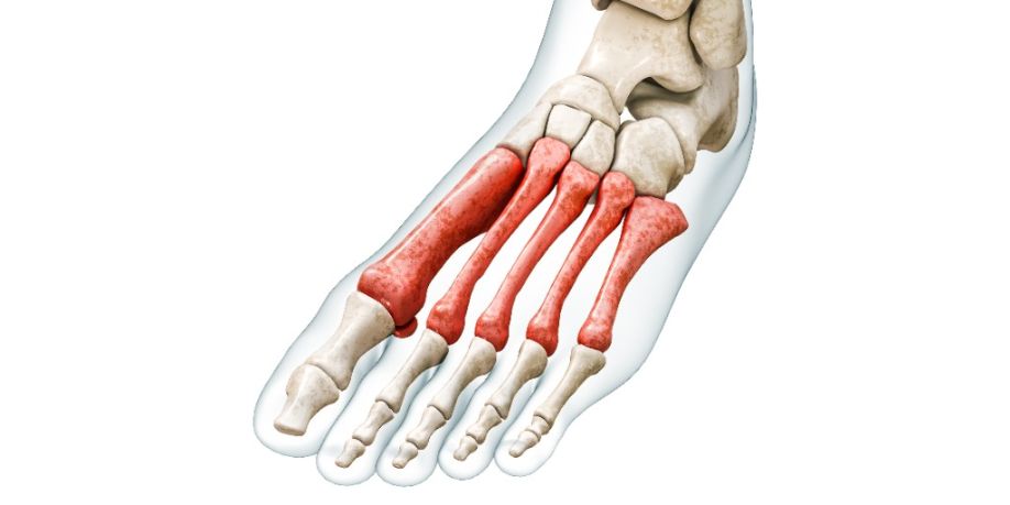 Ilustración de los huesos metatarsianos o metatarso en rojo