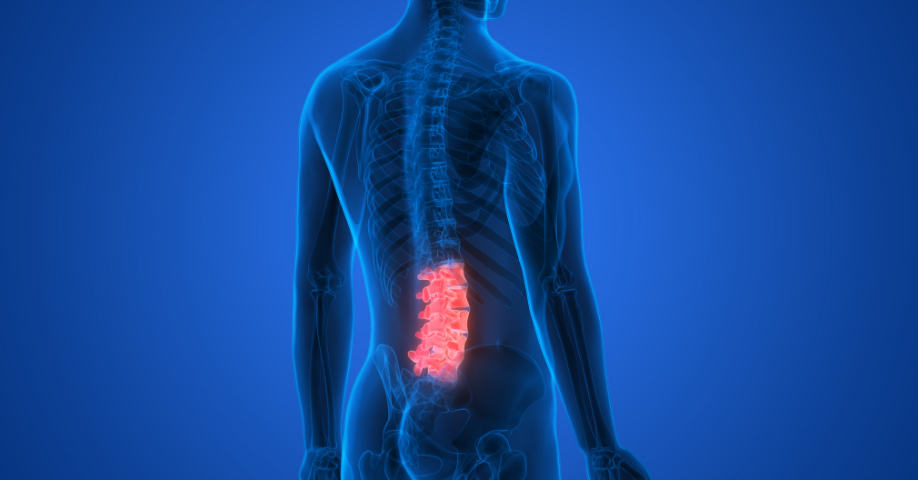 Síntomas de la artrosis de espalda
