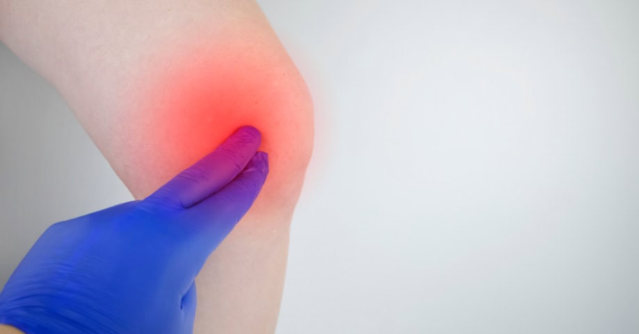 Síntomas de un edema óseo