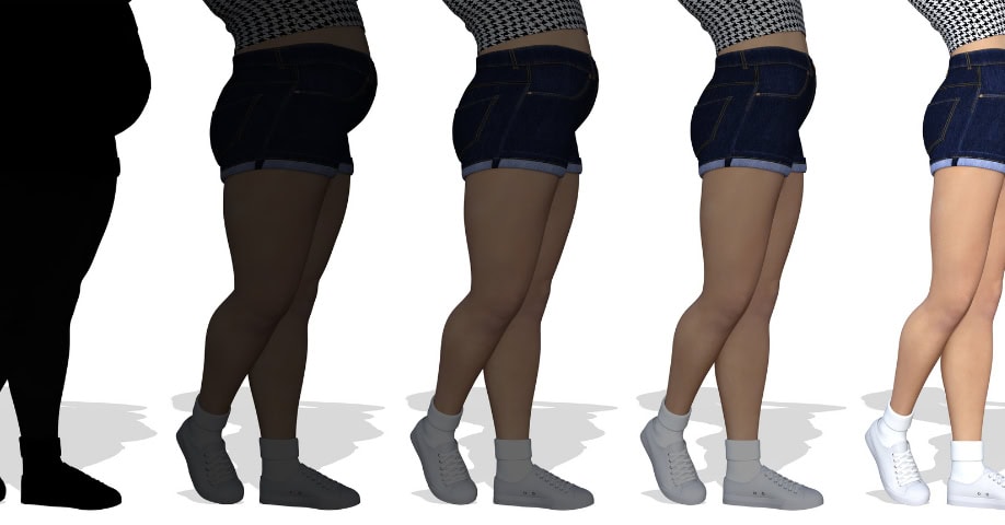 Grados de lipedema