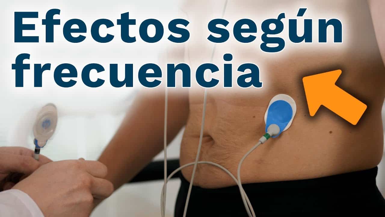 Guía de electroestimulación muscular: beneficios, contraindicaciones y resultados