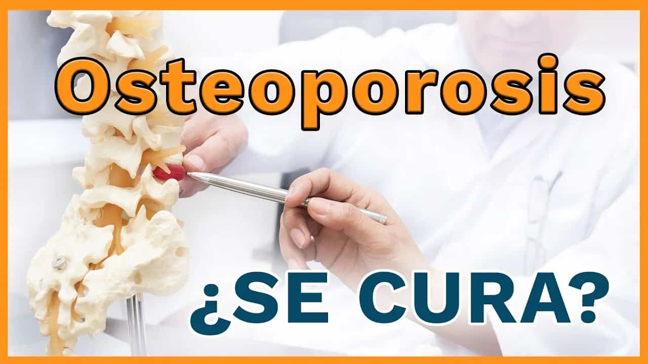 Osteoporosis: ¿por qué surge y qué puedes hacer?