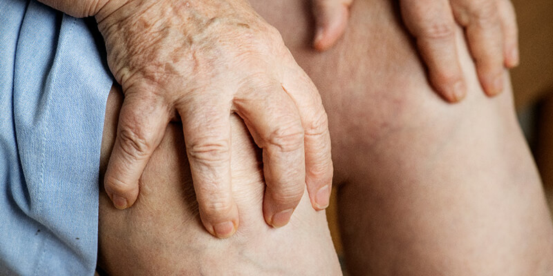¿Por qué aparece la artrosis y cómo tratarla?