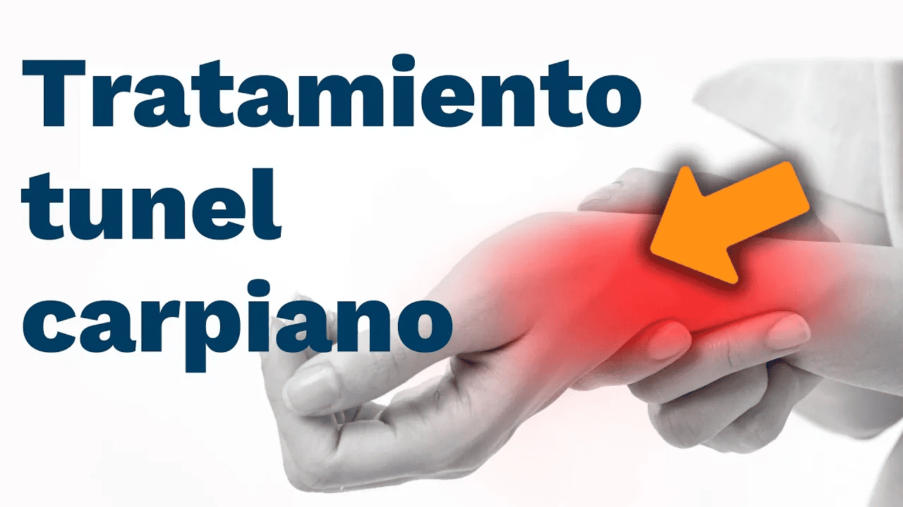 Tratamiento para el túnel carpiano - Clínica de Fisioterapia en Alcalá -  Fisio And Therapies