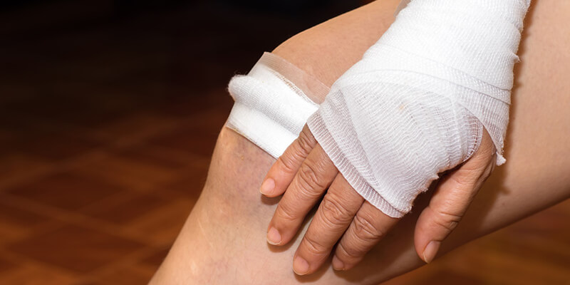Cómo tratar las úlceras cutáneas con magnetoterapia